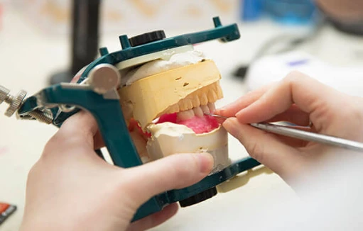 custom-denture-fabrication Hands adjusting a complete denture on a dental model during denture fabrication.