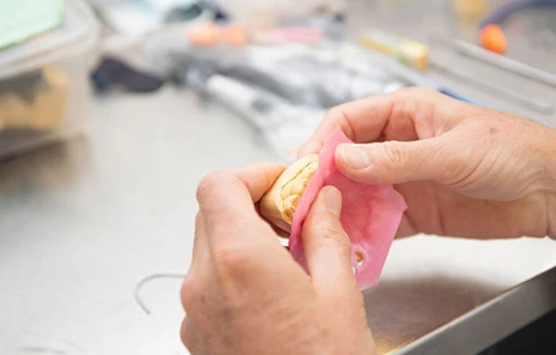 denture-reline Hands relining a denture on a dental model during a denture reline procedure.