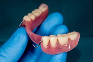 Can You Add Teeth to a Partial Denture set