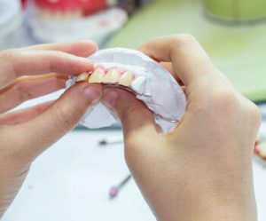 How Do You Clean Badly Stained Dentures fit