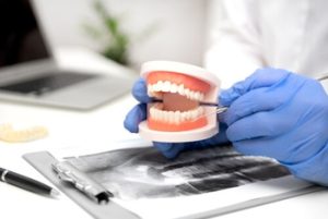 Partial Dentures For Front Teeth consult