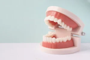 When To Get Dentures set