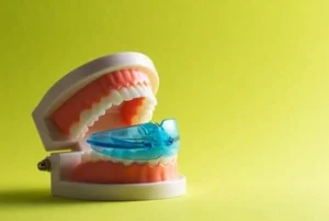 Night Mouth Guard use