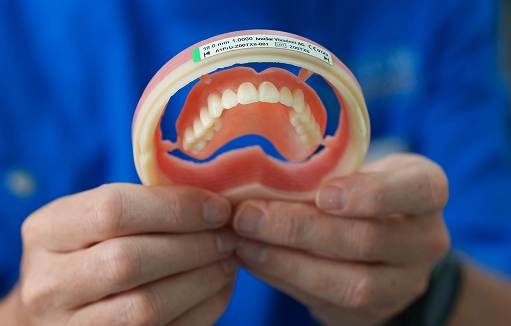 full-arch-dental-implant-model Dental implant model showing a full upper arch prosthesis held in hands for patient education and treatment explanation.