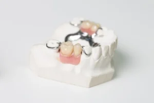 partial-dentures-with-clasp