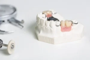 how to whiten dentures over time