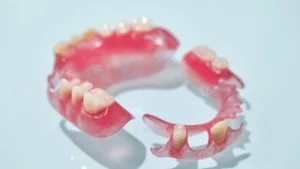 what is a partial dentures set